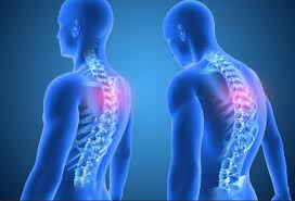 Is Poor Posture Causing Your Back Pain?