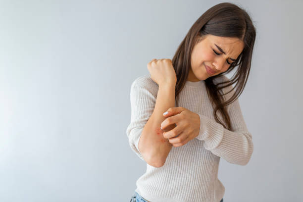 Female Bacterial Infections